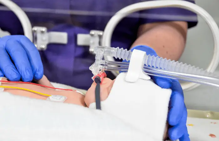 Picture of a model baby connected to an Armstrong Medical breathing circuit Picture of a model baby connected to an Armstrong Medical breathing circuit