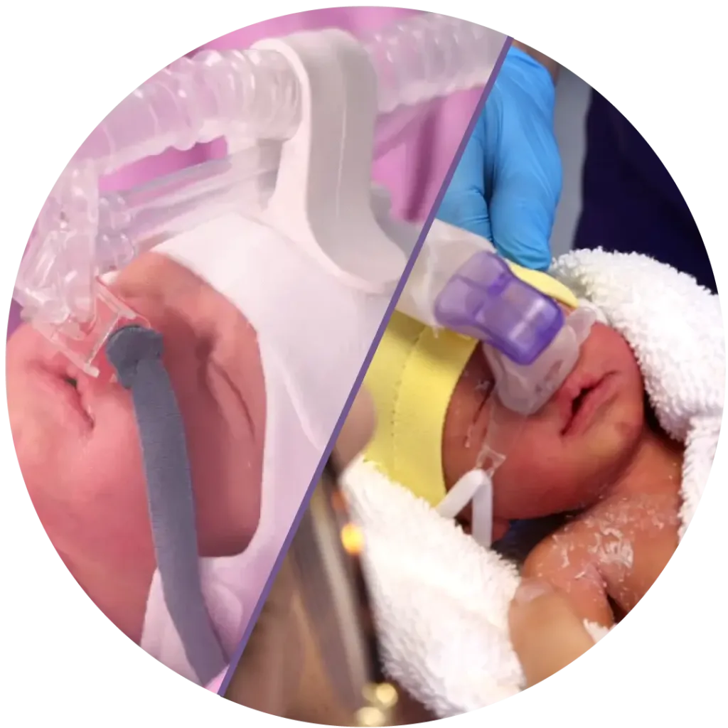 Solutions to fit various CPAP delivery methods Eakin Healthcare