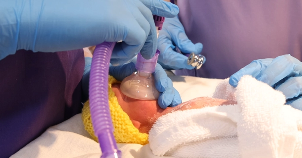 The benefits of heated humidified gases in the delivery suite 1 Eakin Healthcare