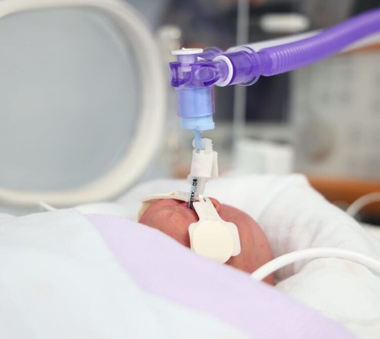 NeoFlow Transport Eakin Healthcare