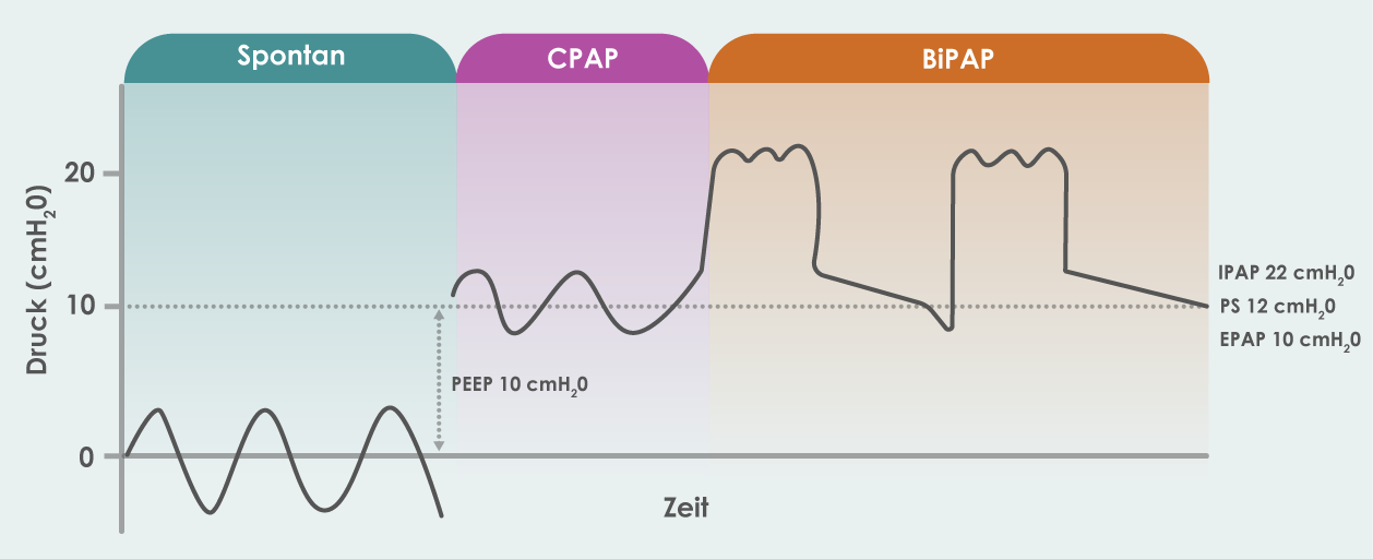 PEEP Graph 2 DE Eakin Healthcare